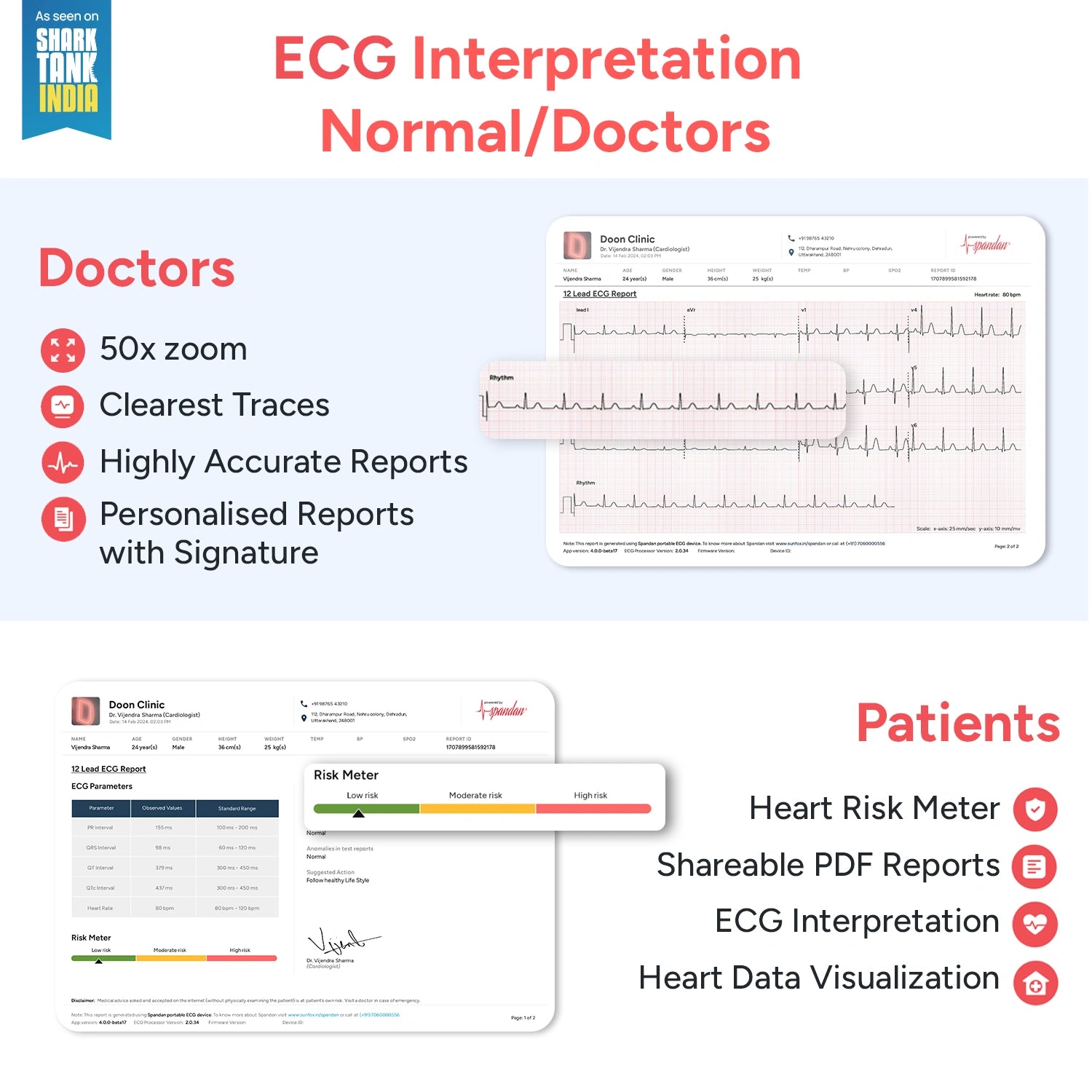 Sunfox : Spandan 4.0 12- Lead Portable ECG Device