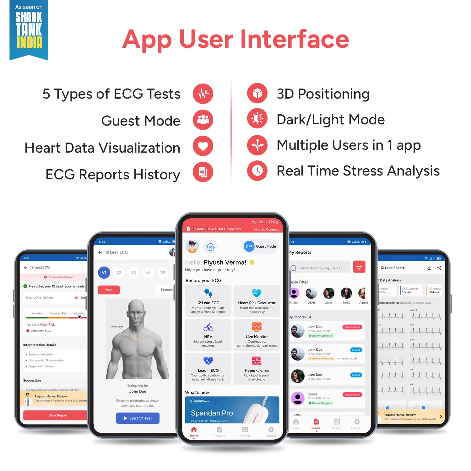 Sunfox : Spandan 4.0 12- Lead Portable ECG Device